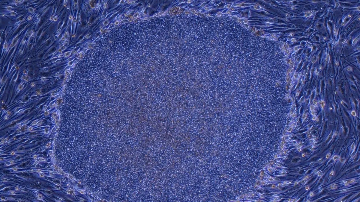 Wereldprimeur: Japanse doorbraken met iPS-cellen in de regeneratieve geneeskunde